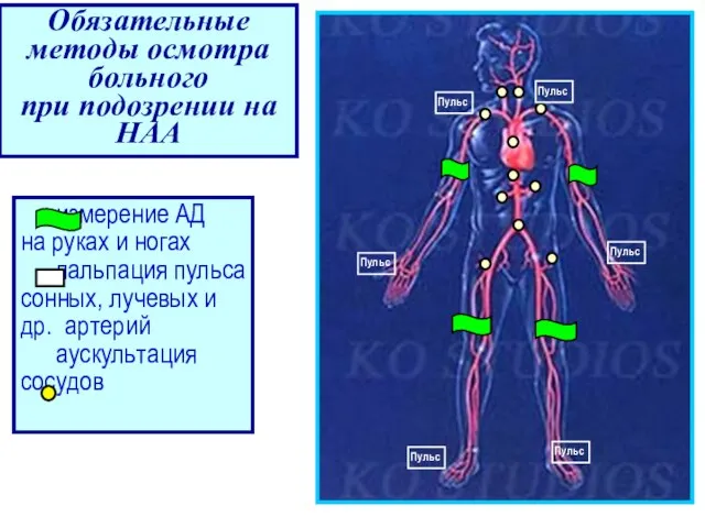 измерение АД на руках и ногах пальпация пульса сонных, лучевых и