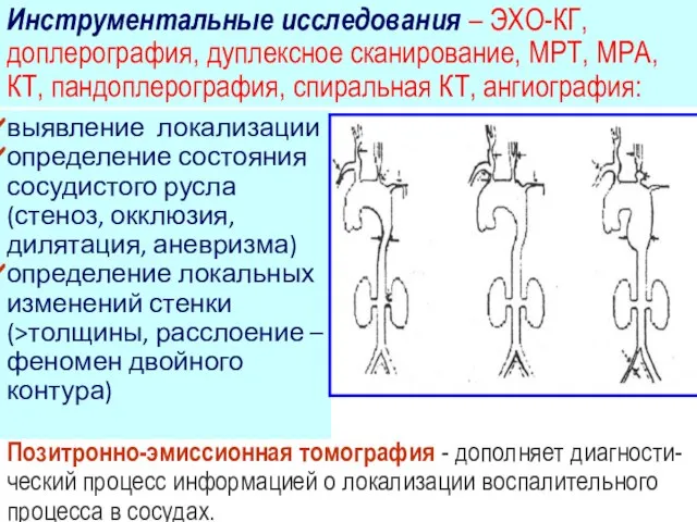 выявление локализации определение состояния сосудистого русла (стеноз, окклюзия, дилятация, аневризма) определение