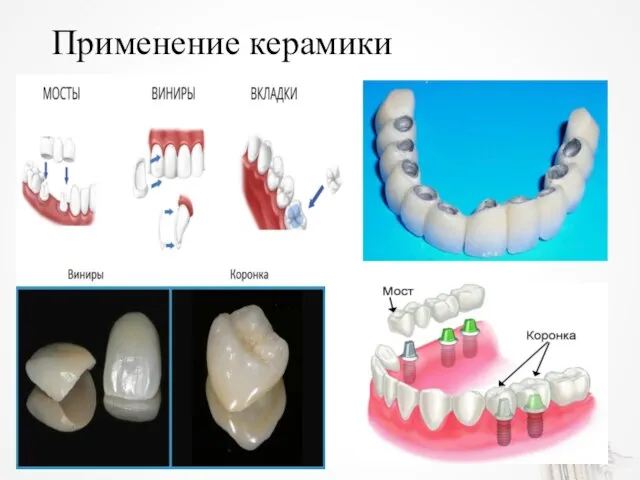 Применение керамики