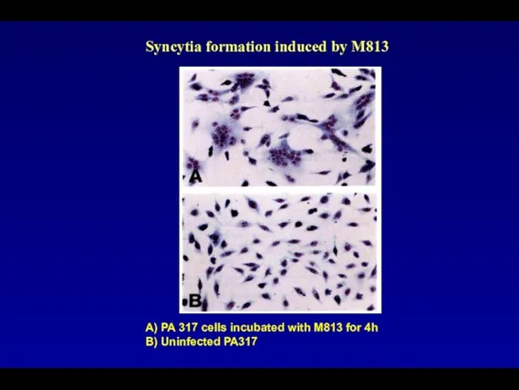 А) PA 317 cells incubated with M813 for 4h B) Uninfected