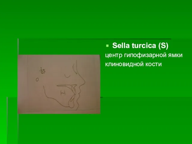 Sella turcica (S) центр гипофизарной ямки клиновидной кости
