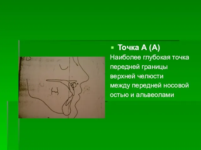 Точка А (А) Наиболее глубокая точка передней границы верхней челюсти между передней носовой остью и альвеолами