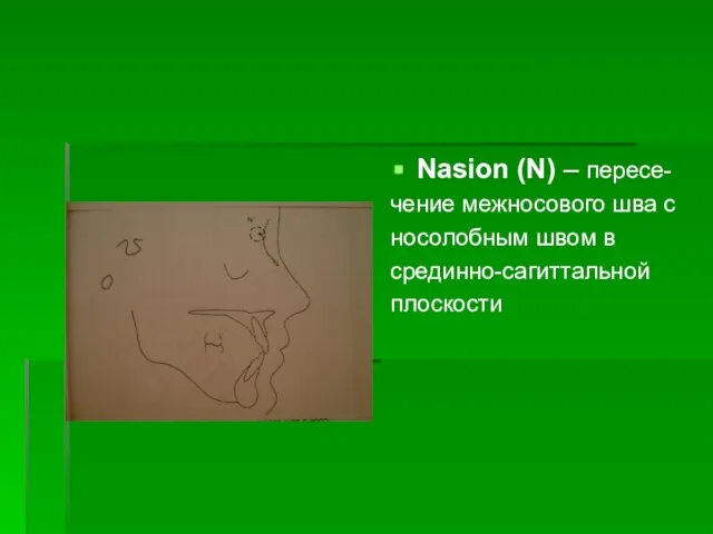 Nasion (N) – пересе- чение межносового шва с носолобным швом в срединно-сагиттальной плоскости