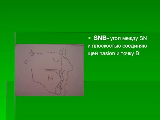 SNB- угол между SN и плоскостью соединяю щей nasion и точку В