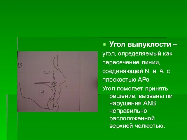 Угол выпуклости – угол, определяемый как пересечение линии, соединяющей N и