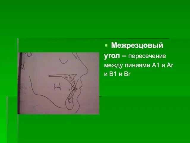 Межрезцовый угол – пересечение между линиями А1 и Аr и В1 и Вr