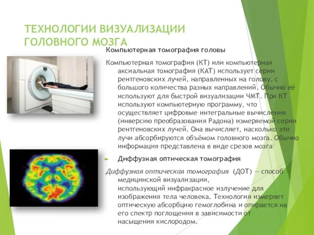 ТЕХНОЛОГИИ ВИЗУАЛИЗАЦИИ ГОЛОВНОГО МОЗГА Компьютерная томография головы Компьютерная томография (КТ) или