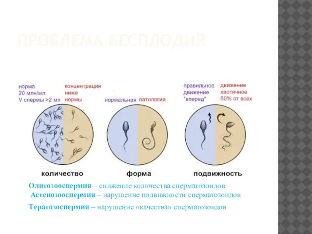 ПРОБЛЕМА БЕСПЛОДИЯ Олигозооспермия – снижение количества сперматозоидов Астенозооспермия – нарушение подвижности