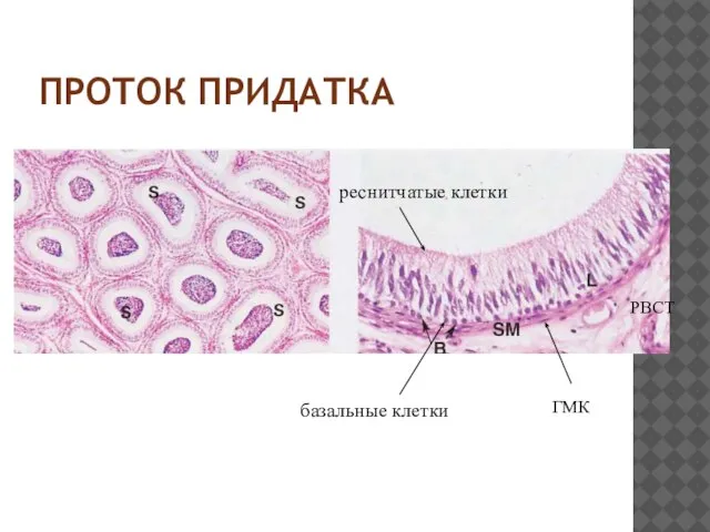 ПРОТОК ПРИДАТКА реснитчатые клетки базальные клетки ГМК РВСТ