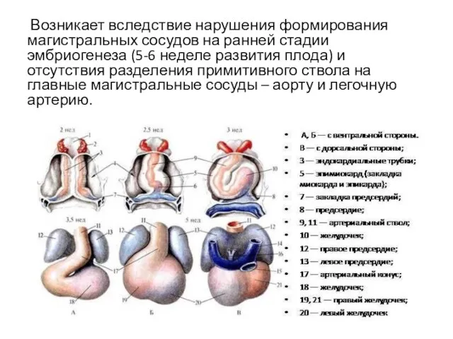 Возникает вследствие нарушения формирования магистральных сосудов на ранней стадии эмбриогенеза (5-6