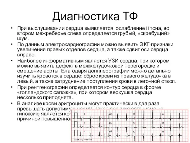 Диагностика ТФ При выслушивании сердца выявляется: ослабление II тона, во втором