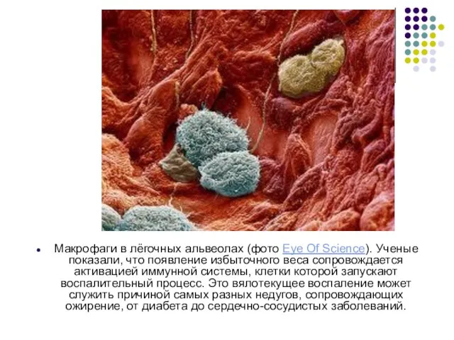 Макрофаги в лёгочных альвеолах (фото Eye Of Science). Ученые показали, что