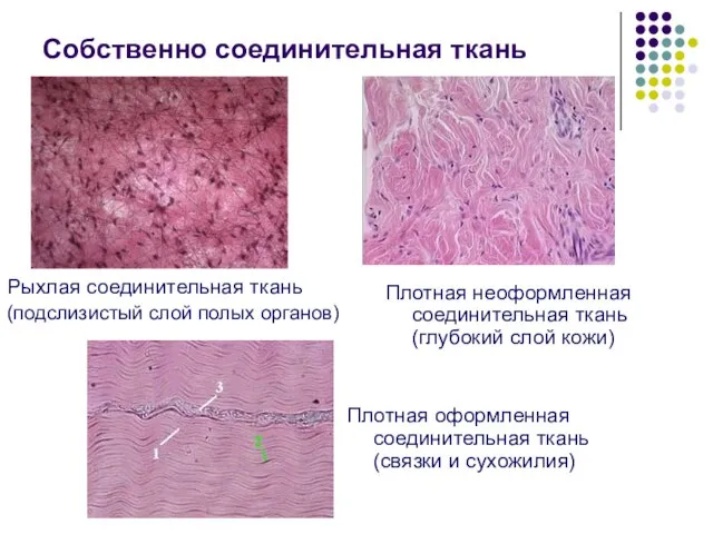 Собственно соединительная ткань Рыхлая соединительная ткань (подслизистый слой полых органов) Плотная