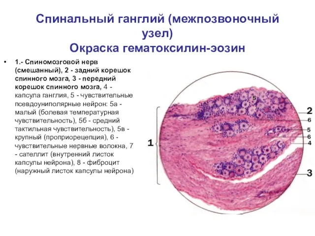 Спинальный ганглий (межпозвоночный узел) Окраска гематоксилин-эозин 1.- Спиномозговой нерв (смешанный), 2