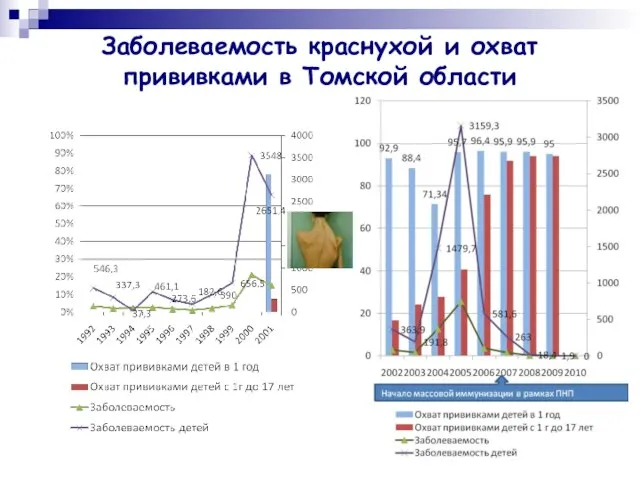Заболеваемость краснухой и охват прививками в Томской области