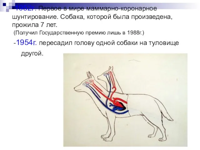 -1952г. Первое в мире маммарно-коронарное шунтирование. Собака, которой была произведена, прожила