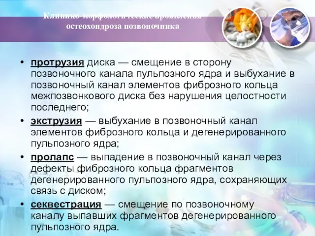 Клинико-морфологические проявления остеохондроза позвоночника протрузия диска — смещение в сторону позвоночного