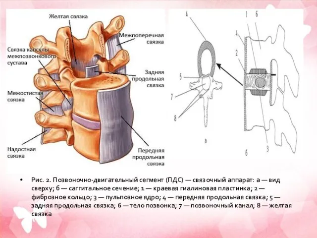 Рис. 2. Позвоночно-двигательный сегмент (ПДС) — связочный аппарат: а — вид