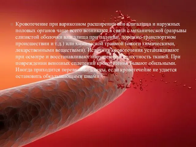 Кровотечение при варикозном расширении вен влагалища и наружных половых органов чаще