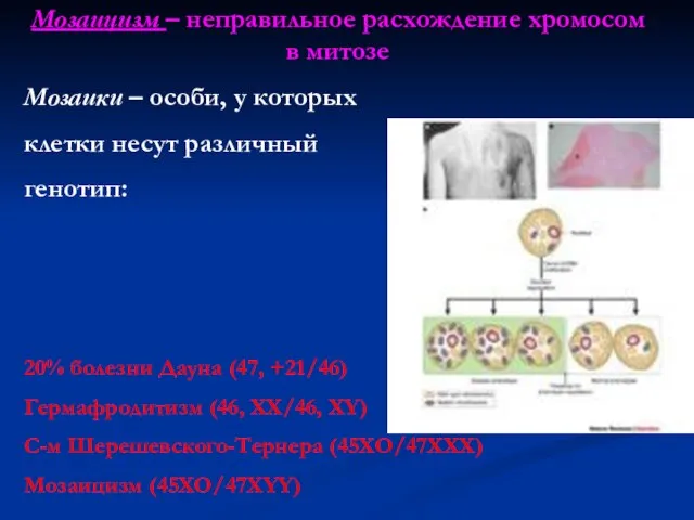 Мозаицизм – неправильное расхождение хромосом в митозе Мозаики – особи, у