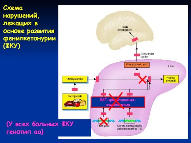 (У всех больных ФКУ генотип аа) ФАГ-фенилаланин-гидроксилаза Схема нарушений, лежащих в основе развития фенилкетонурии (ФКУ)