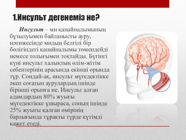 1.Инсульт дегенеміз не? Инсульт – ми қанайналымының бұзылуымен байланысты ауру, нәтижесінде