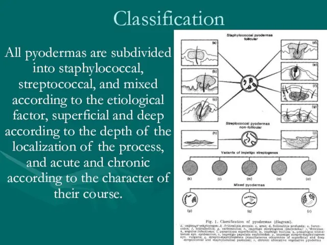 Classification All pyodermas are subdivided into staphylococcal, streptococcal, and mixed according