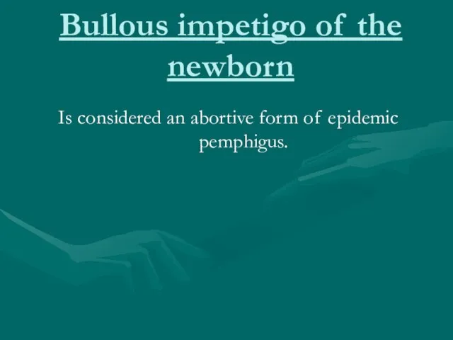 Bullous impetigo of the newborn Is considered an abortive form of epidemic pemphigus.