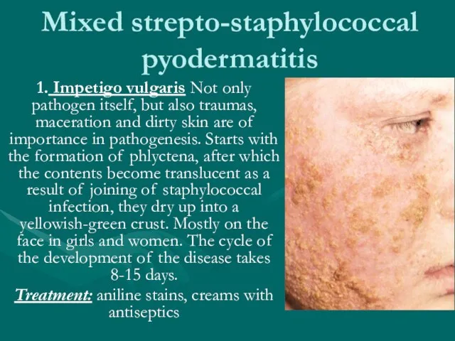 Mixed strepto-staphylococcal pyodermatitis 1. Impetigo vulgaris Not only pathogen itself, but