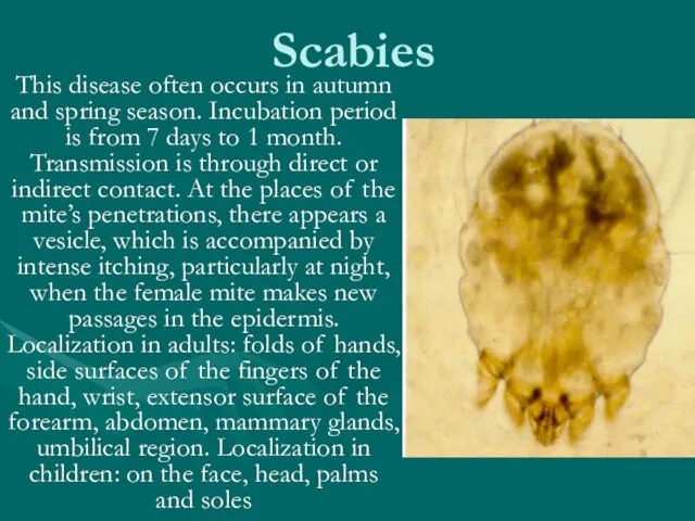 Scabies This disease often occurs in autumn and spring season. Incubation