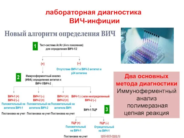 лабораторная диагностика ВИЧ-инфиции Два основных метода диагностики Иммуноферментный анализ полимеразная цепная реакция