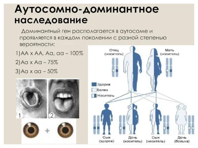 Аутосомно-доминантное наследование Доминантный ген располагается в аутосоме и проявляется в каждом