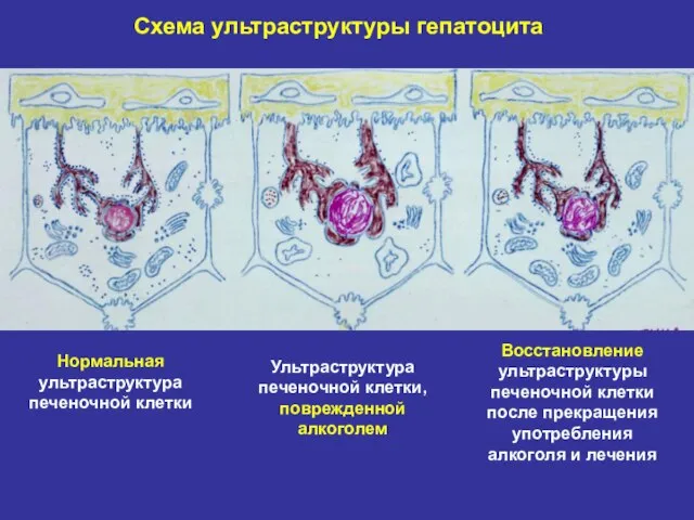 Схема ультраструктуры гепатоцита Нормальная ультраструктура печеночной клетки Ультраструктура печеночной клетки, поврежденной