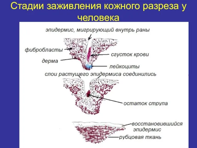 Стадии заживления кожного разреза у человека