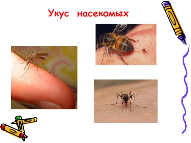 Укус насекомых