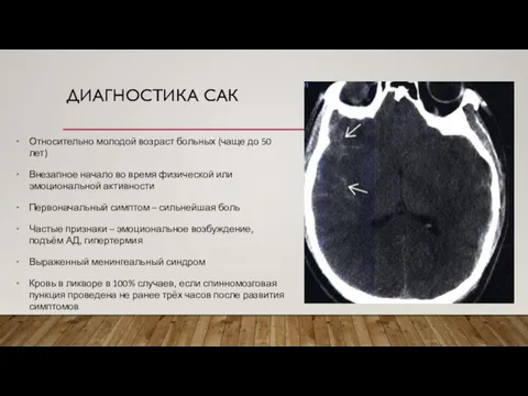 ДИАГНОСТИКА САК Относительно молодой возраст больных (чаще до 50 лет) Внезапное