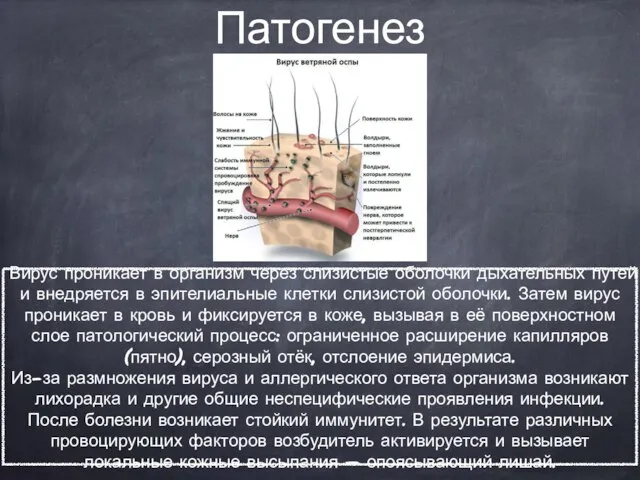 Патогенез