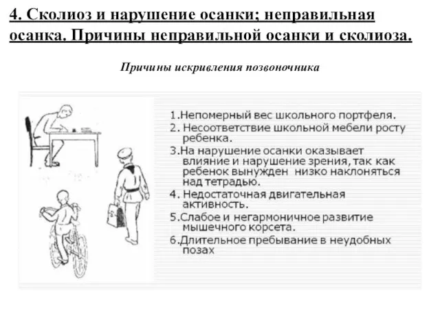 4. Сколиоз и нарушение осанки; неправильная осанка. Причины неправильной осанки и сколиоза. Причины искривления позвоночника