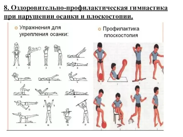 8. Оздоровительно-профилактическая гимнастика при нарушении осанки и плоскостопии.