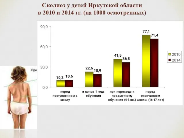 Сколиоз у детей Иркутской области в 2010 и 2014 гг. (на 1000 осмотренных)