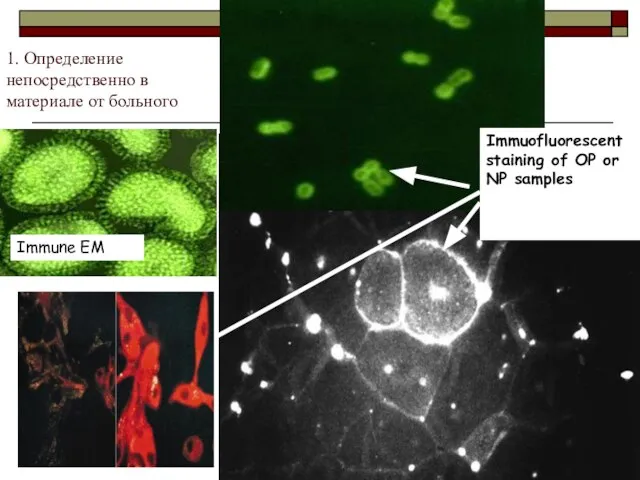 1. Определение непосредственно в материале от больного Immune EM Immuofluorescent staining of OP or NP samples