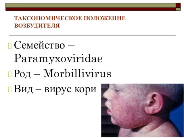 ТАКСОНОМИЧЕСКОЕ ПОЛОЖЕНИЕ ВОЗБУДИТЕЛЯ Семейство – Paramyxoviridae Род – Morbillivirus Вид – вирус кори