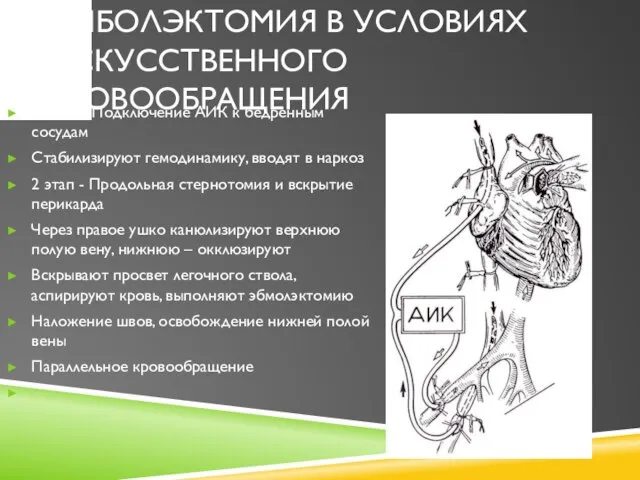 ЭМБОЛЭКТОМИЯ В УСЛОВИЯХ ИСКУССТВЕННОГО КРОВООБРАЩЕНИЯ 1 этап – Подключение АИК к