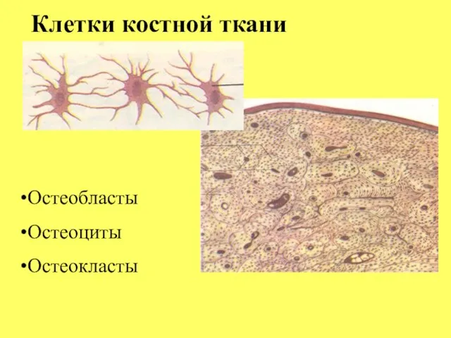 Клетки костной ткани Остеобласты Остеоциты Остеокласты