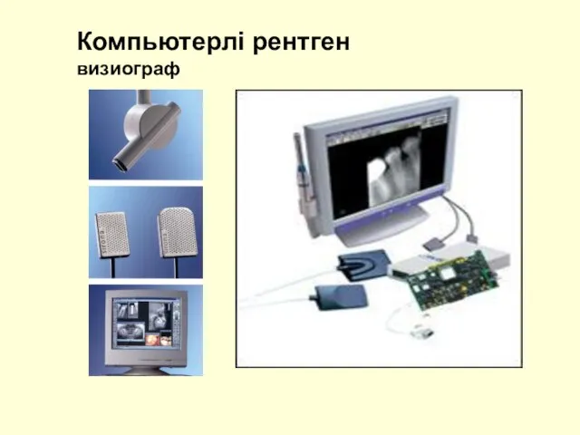 Компьютерлі рентген визиограф