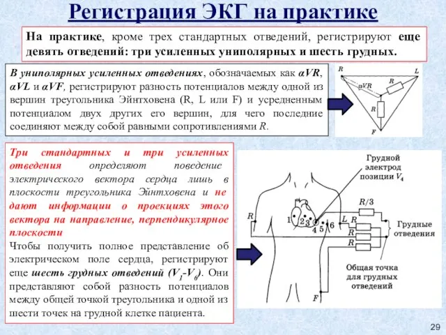 Регистрация ЭКГ на практике На практике, кроме трех стандартных отведений, регистрируют