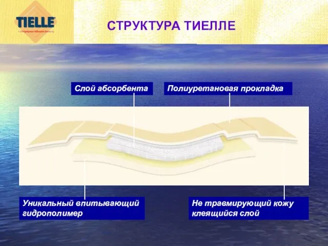 СТРУКТУРА ТИЕЛЛЕ Уникальный впитывающий гидрополимер Слой абсорбента Не травмирующий кожу клеящийся слой Полиуретановая прокладка