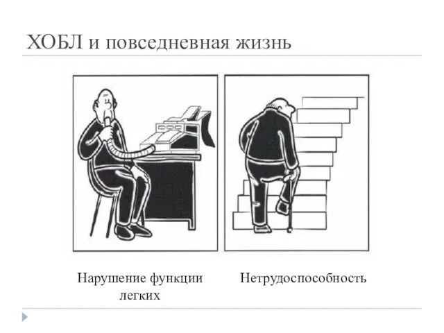 ХОБЛ и повседневная жизнь Нарушение функции легких Нетрудоспособность