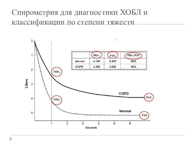 Спирометрия для диагностики ХОБЛ и классификации по степени тяжести