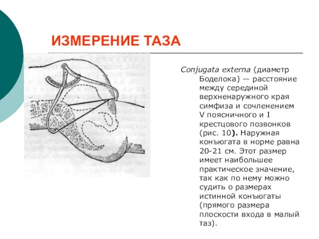 ИЗМЕРЕНИЕ ТАЗА Conjugata externa (диаметр Боделока) — расстояние между серединой верхненаружного